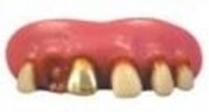 Picture of Sp. Offer - Billy Bob Teeth - Gold Miner