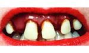 Picture of Sp. Offer - Billy Bob Teeth - Betty Bob